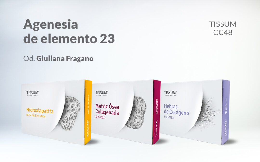 Agenesia de elemento 23