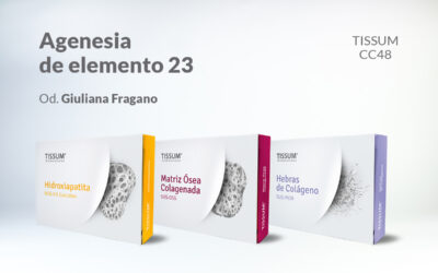 Agenesia de elemento 23